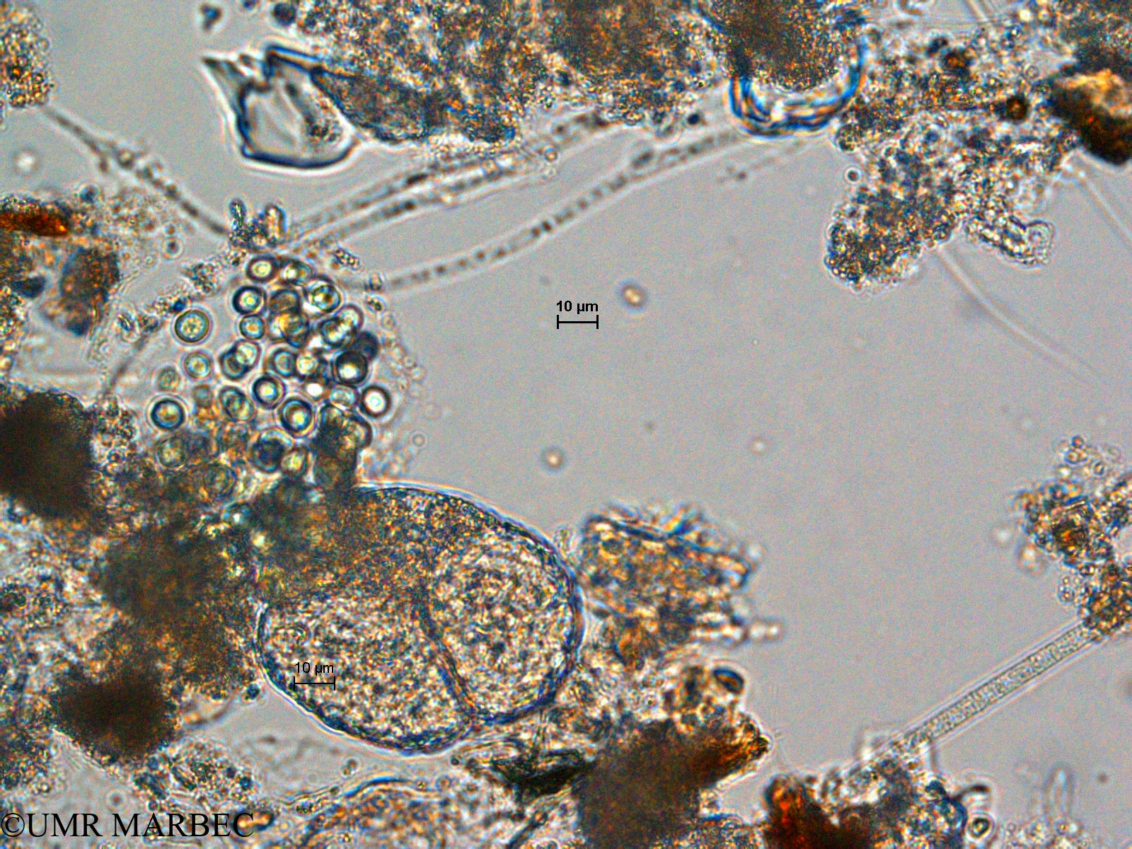 phyto/Scattered_Islands/europa/COMMA April 2011/Chroococcus sp9 (1)(copy).jpg